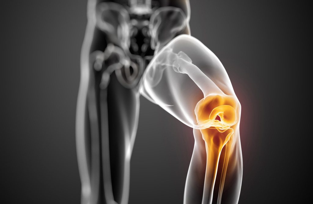 deformáló osteoarthritis az 1. fokú kezelés a csípőízület artrózisa 2 fokos kezelés