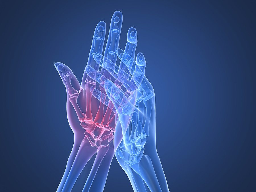 hogyan lehet kezelni a rheumatoid arthritis és az arthrosis